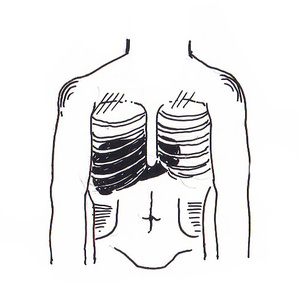 <sup>3</sup> [] 