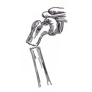  <sup>2</sup>