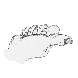 [] <sup>1</sup>